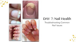 Bliss Kiss™ Challenge Day 7 Nail Health Trouble Shooting Common Nail Health Issues [upl. by Neened]