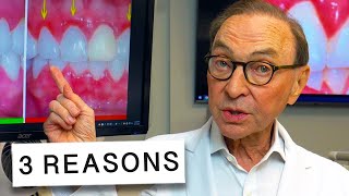 3 Reasons Your Gums Are Inflamed and How to Treat at Home 🦷🔥 [upl. by Francie]