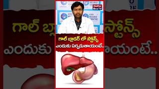 Gallstones Causes  All you need to know l Dr Nagarjuna shorts MEDplusedplusOneTV [upl. by Powe]