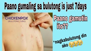 PAANO GUMALING ANG BULUTONG IN JUST 7dayspaano ito gamutinMITCH ICBAN [upl. by Egide]