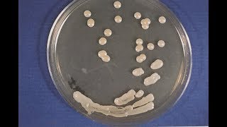 Cryptococcosis  Opportunistic Mycoses 1 S0125 Microbiology MCQs [upl. by Nahtnahoj]