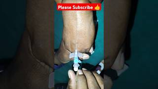 Cannula Technique  IV Cannula Insertation Technique short viral video trend reels cannula [upl. by Isoj]