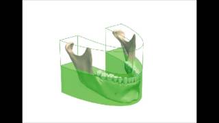 Panouramic Cephalometric routine quality control testing Ver 3 [upl. by Len]