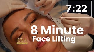 8Minute Face Lifting using COG threads [upl. by Siul]