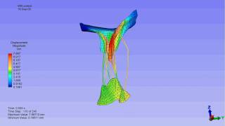 Finite element model of a mitral valve [upl. by Ymeon]