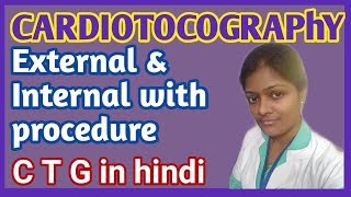 Cardiotocography in hindi  Electronic fetal monitor Type of CTG  purpose of CTG Procedure of CTG [upl. by Townshend]