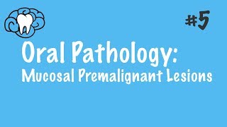 Oral Pathology  Mucosal Premalignant Lesions  INBDE ADAT [upl. by Constantine]