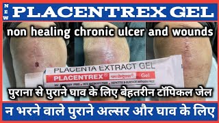 प्लेसेंट्रेक्स जेल कौन सा घाव ठीक करने में काम आता है  PLACENTREX GEL [upl. by Manoff]