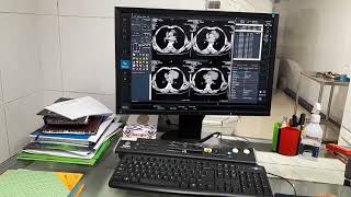 CT Urogram  CTU Discussion [upl. by Lulu726]