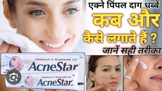 Acnestar gel review  Acnestar gel  Acnesatr for acne amp pimples uses in Hindi apnamedicaltips99 [upl. by Anivlem]