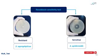 Novobiocin Sensitivity Test [upl. by Frere]