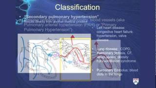 Pulmonary Hypertension A challenging cause of shortness of breath [upl. by Hibbs]