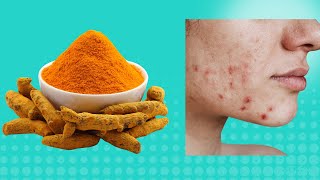 How To Use Turmeric For Skin Issues [upl. by Aicek]