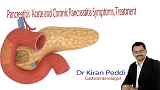 Pancreatitis  Acute and Chronic Pancreatitis Nursing Lecture Symptoms Treatment Dr Kiran Peddi [upl. by Ostraw372]