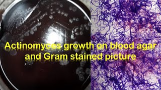 Actinomyces growth on blood agar and Gram stained smear [upl. by Albina]