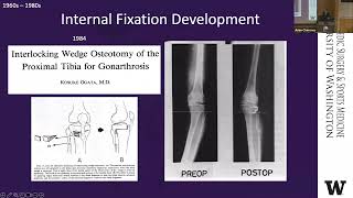 Osteotomy Past Present and Future [upl. by Ynnij695]