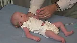 423  Primitive Reflexes Moro Reflex  Newborn Abnormal  Infant Clinical ExaminationMRCP [upl. by Volny759]