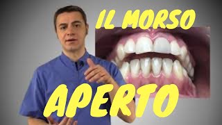 Il Morso Aperto [upl. by Gough]