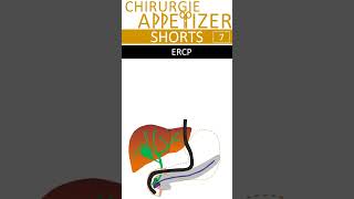 CHIRURGIE APPetizer SHORTS Nr8 ERCP medicalstudent [upl. by Aihppa]