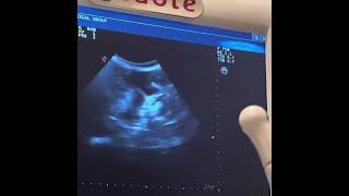 French Bulldog Ultrasound 52 Days Pregnancy [upl. by Corydon989]