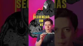 ENTENDIENDO SECUENCIAS DE RESONANCIA MAGNÉTICA P2 rm radiología salud cerebro mri [upl. by Lowell]