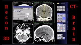 LEARN RECONSTRUCTION CT HEAD SCAN  SIEMENS 16 SLICE [upl. by Alegna]