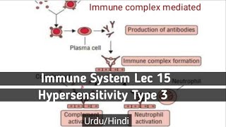 Immune complex mediated type 3 hypersensitivityUrduHindi [upl. by Eittah]