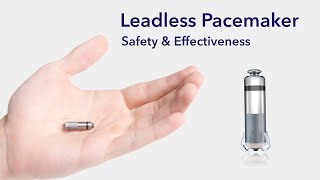 Cardiac Treatment Leadless Pacemakers [upl. by Ingmar]