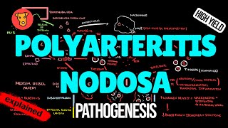 POLYARTERITIS NODOSA Pathogenesis Mechanism of Clinical symptoms Treatment [upl. by Granoff]