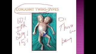 Twinning drchitrashumananatomy [upl. by Ylicic]