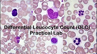 Differential Leucocyte Count DLC Practical Lab [upl. by Rinum4]