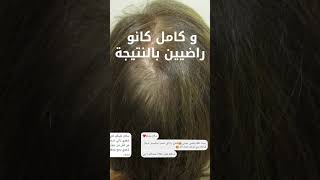 Stoppez la Chute des Cheveux avec Notre Pack AntiChute  امنع تساقط شعرك الآن [upl. by Reniar]