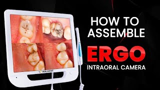 How to assemble ERGO intraoral camera  Waldent [upl. by Katrina]