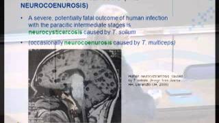 Taenia solium cysticercosis Life cycle epidemiology and diagnosis Dr L Odendaal [upl. by Aneerahs]