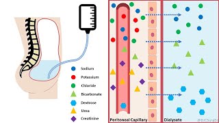 Peritoneal Dialysis [upl. by Stewart507]