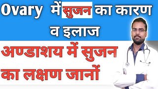 Ovary में सूजन का कारण व इलाज  Ovary me Sujan kaise hota hai Ovary me sujan [upl. by Dafodil]