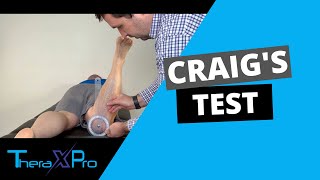 Craigs Test  Femoral Anteversion  Femoral Retroversion [upl. by Ayortal111]