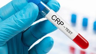 CRP  CReactive proteincrp test procedurewhat does c mean in crpdrnajeebviralhealthscience [upl. by Tnomad]