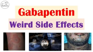 Gabapentin Weird Side Effects Skin Psychological Eyes [upl. by Nael27]