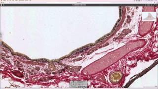 Histology of the lung [upl. by Branca]