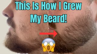 This Is How I Grew My Beard With Minoxidil And a Derma Stamp [upl. by Maloy16]