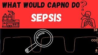 What would CAPNO do Sepsis [upl. by Hett]