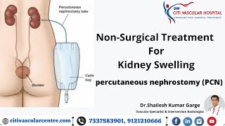 Percutaneous Nephrostomy  PCN  Non Surgical Treatment for Kidney Swelling  Official Video [upl. by Bentley560]