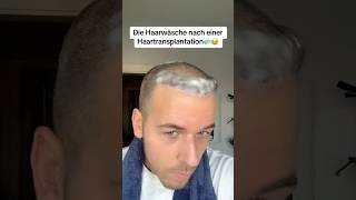 Haarwäsche nach einer Haartransplantation🧼😂  Valettino [upl. by Schrick]