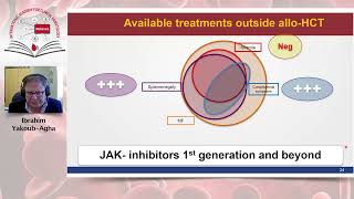 Allogeneic Stem Cell Transplantation for Myelofibrosis [upl. by Ecaj]