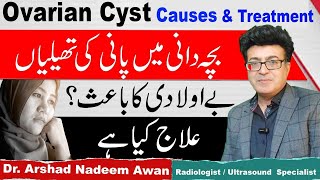 Ovarian Cysts TypesCausesSymptoms And Treatment In Urdu [upl. by Odlonyer336]