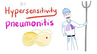 Hypersensitivity Pneumonitis  Restrictive Lung Diseases  Pulmonology [upl. by Farhsa]