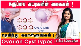 Ovarian Cyst   கருப்பை நீர்க்கட்டிகள்   Types Of Cyst   Explained By DrBYoga Vidhya [upl. by Lieberman267]