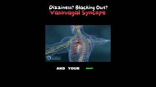 What is Vasovagal Syncope blackingout fainting [upl. by Aihsekel]