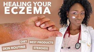 How to Treat ECZEMAAtopic Dermatitis Black Dark Skin Dry Flaky Skincare Routine Hyperpigmentation [upl. by Ayhtak]